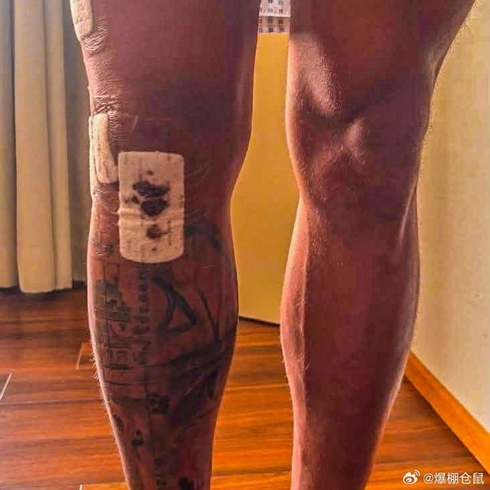 热刺中场哈维-西蒙斯接受膝盖手术 长期缺席美加